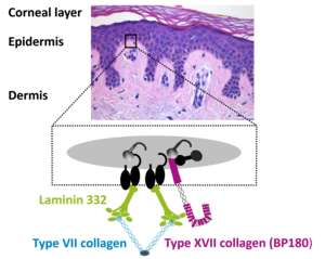 Shown is the localization of the autoantigens of Pepmhigoid diseases. The main Autoantigens are Laminin 332 and Collagen type 7 and Collagen type 17 located at the dermo-epidermal junction in our skin