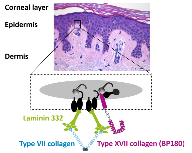 Shown is the localization of the autoantigens of Pepmhigoid diseases. The main Autoantigens are Laminin 332 and Collagen type 7 and Collagen type 17 located at the dermo-epidermal junction in our skin
